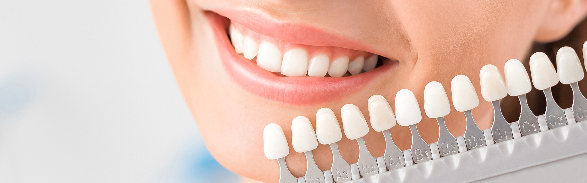 Say Goodbye to Stained Teeth with Porcelain Veneers